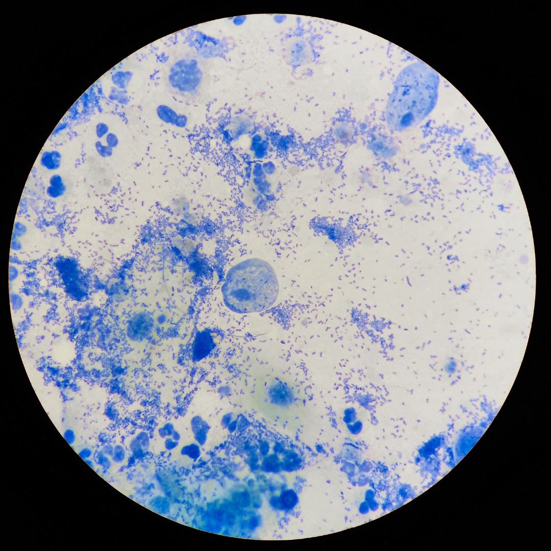 Trichomonas szűrés